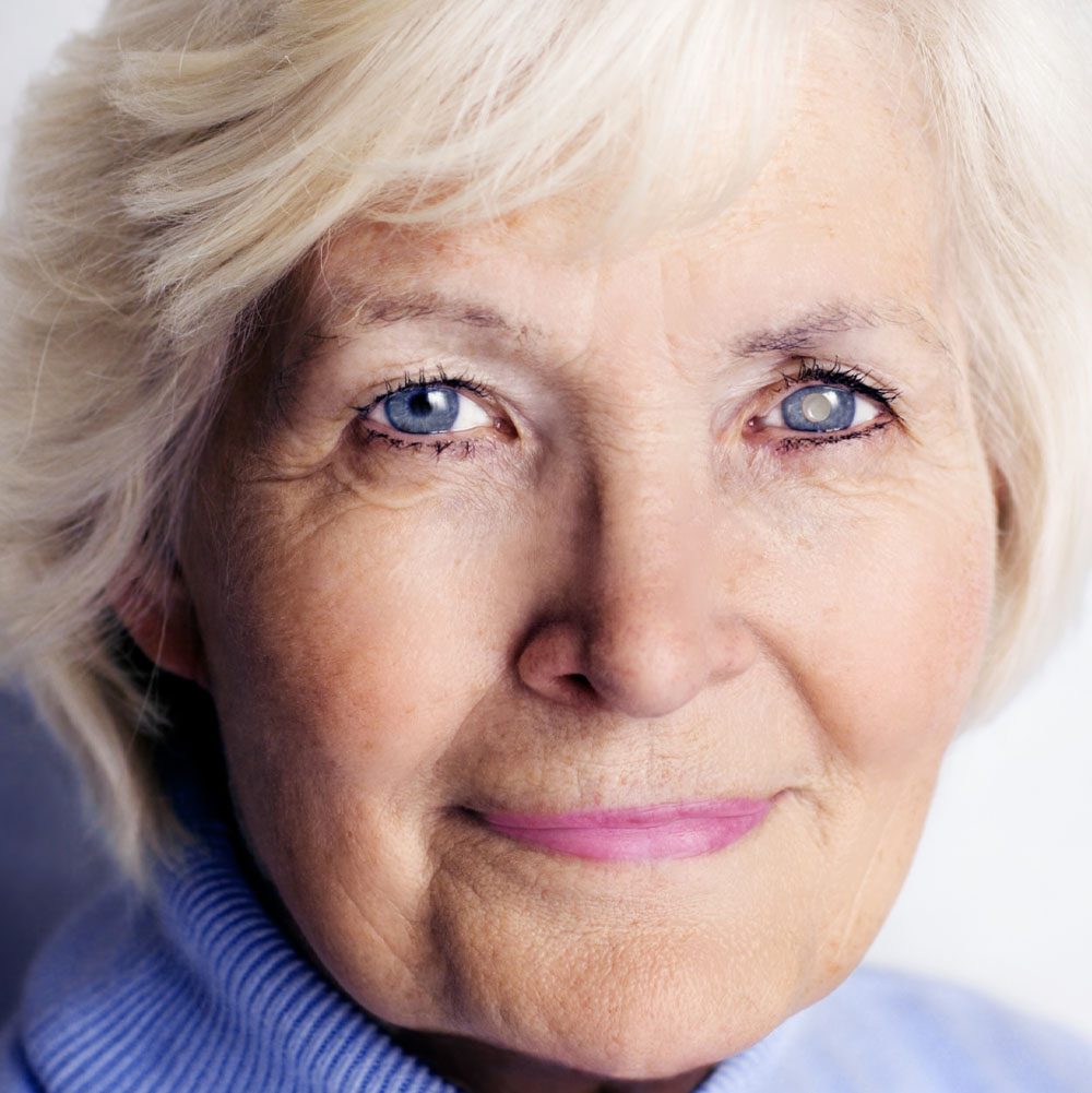Cataract Surgery Co-Management in Westheimer Lakes North